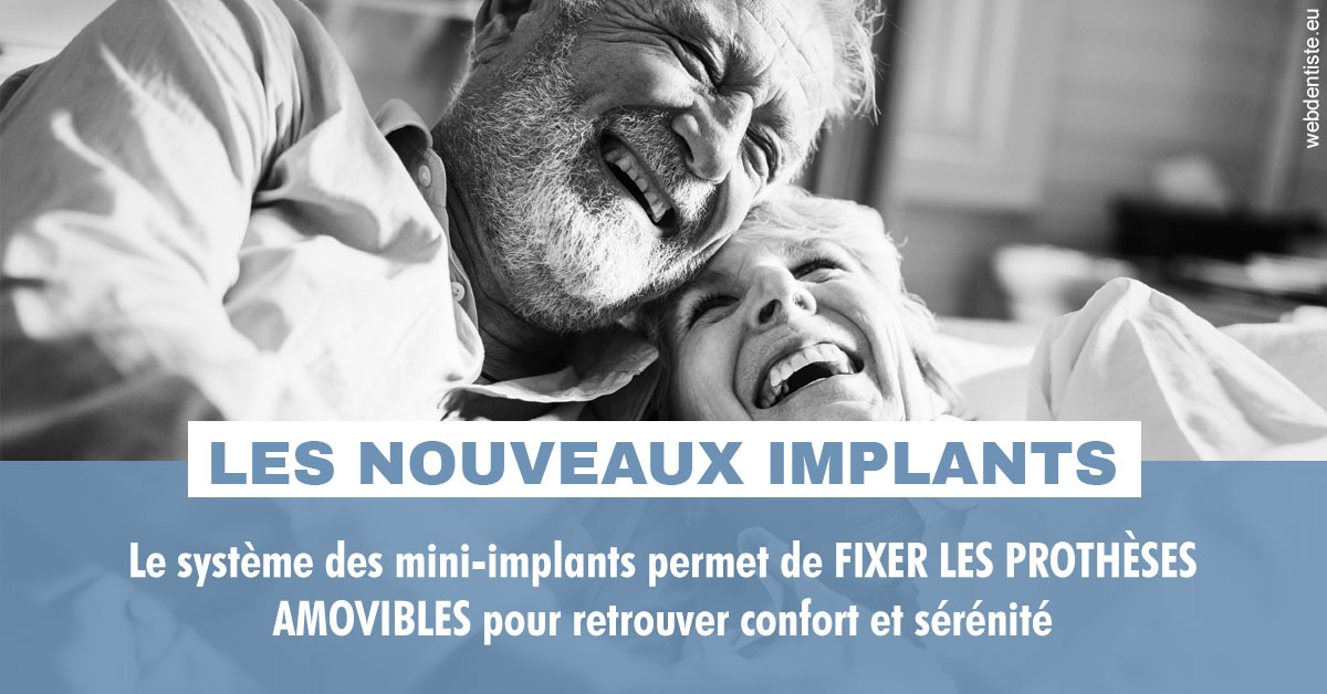 https://dr-baudouin-gilles.chirurgiens-dentistes.fr/Les nouveaux implants 2