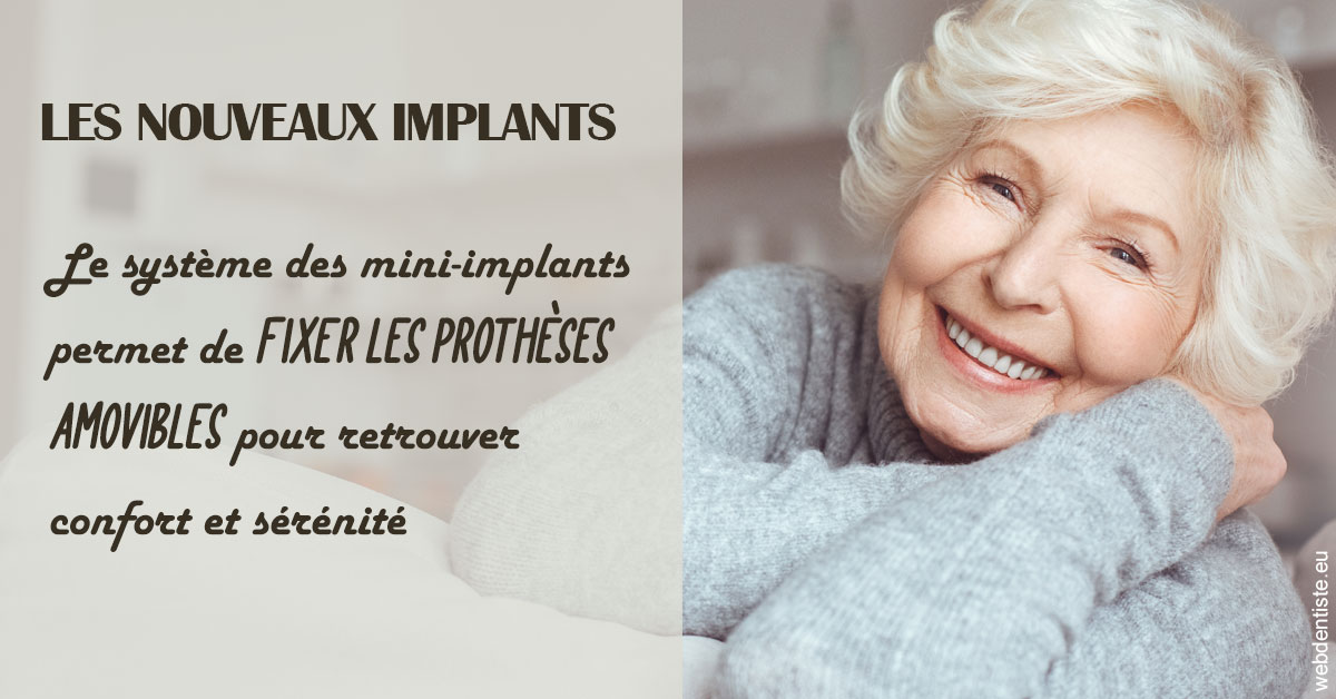 https://dr-baudouin-gilles.chirurgiens-dentistes.fr/Les nouveaux implants 1