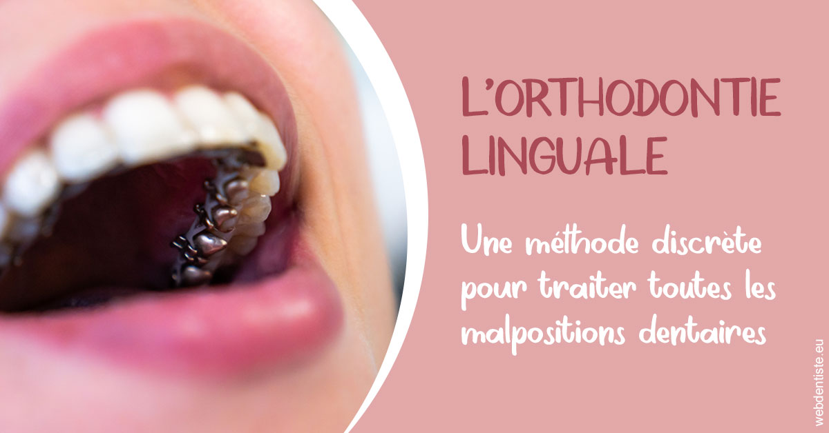 https://dr-baudouin-gilles.chirurgiens-dentistes.fr/L'orthodontie linguale 2