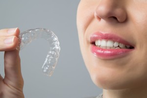 La technique Invisalign® - Orthodontie invisible