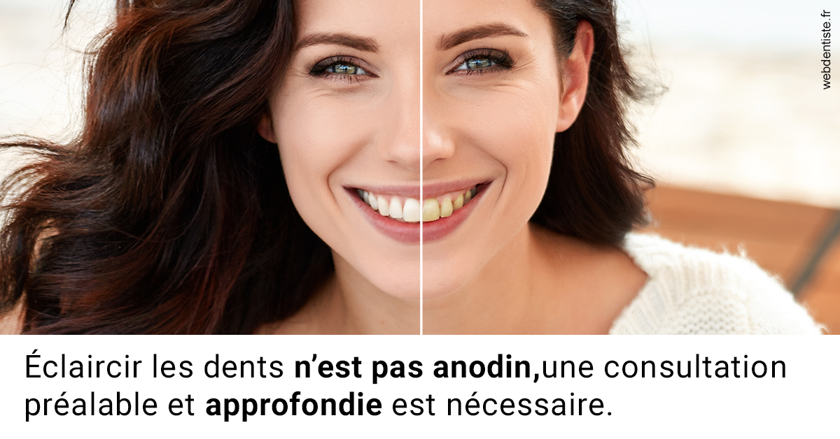 https://dr-baudouin-gilles.chirurgiens-dentistes.fr/Le blanchiment 2