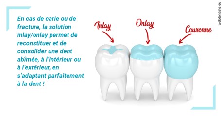 https://dr-baudouin-gilles.chirurgiens-dentistes.fr/L'INLAY ou l'ONLAY