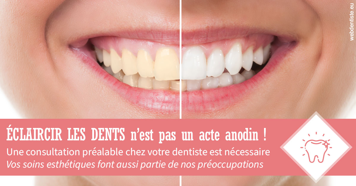 https://dr-baudouin-gilles.chirurgiens-dentistes.fr/Eclaircir les dents 1