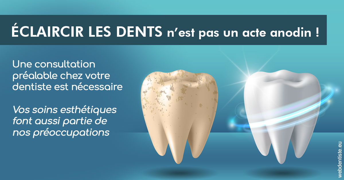 https://dr-baudouin-gilles.chirurgiens-dentistes.fr/Eclaircir les dents 2