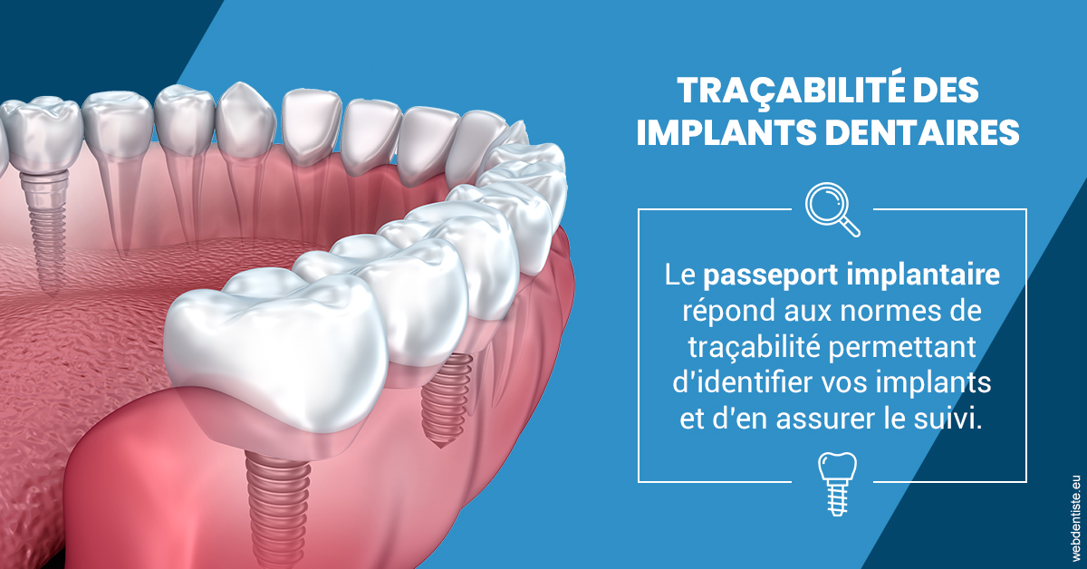 https://dr-baudouin-gilles.chirurgiens-dentistes.fr/T2 2023 - Traçabilité des implants 1
