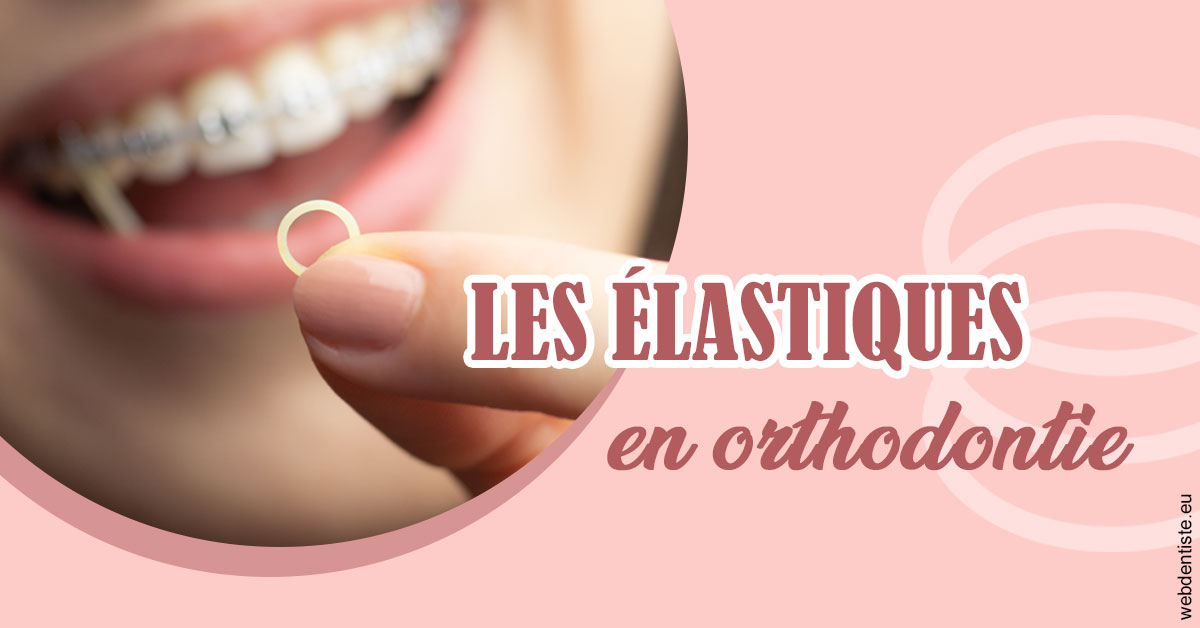 https://dr-baudouin-gilles.chirurgiens-dentistes.fr/Elastiques orthodontie 1