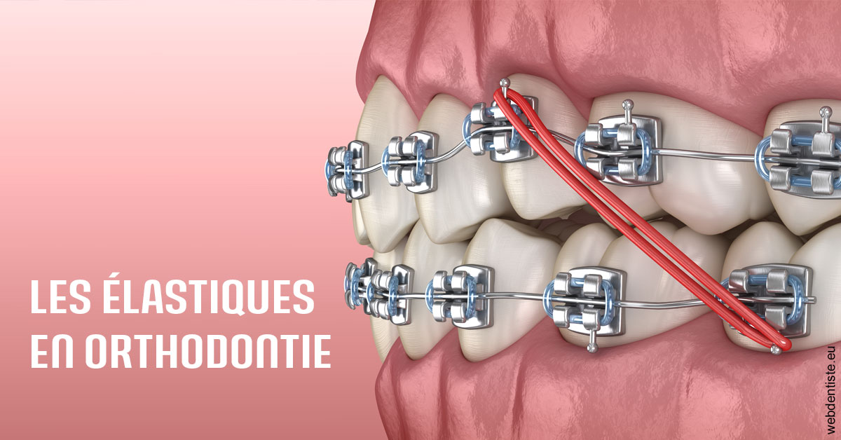https://dr-baudouin-gilles.chirurgiens-dentistes.fr/Elastiques orthodontie 2