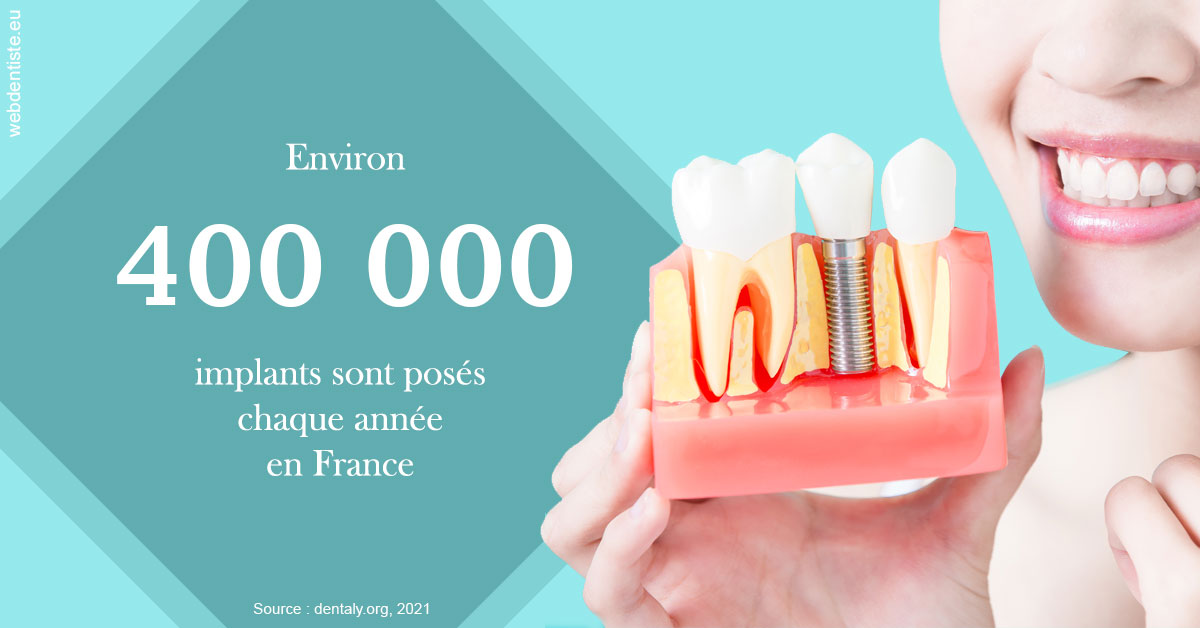 https://dr-baudouin-gilles.chirurgiens-dentistes.fr/Pose d'implants en France 2